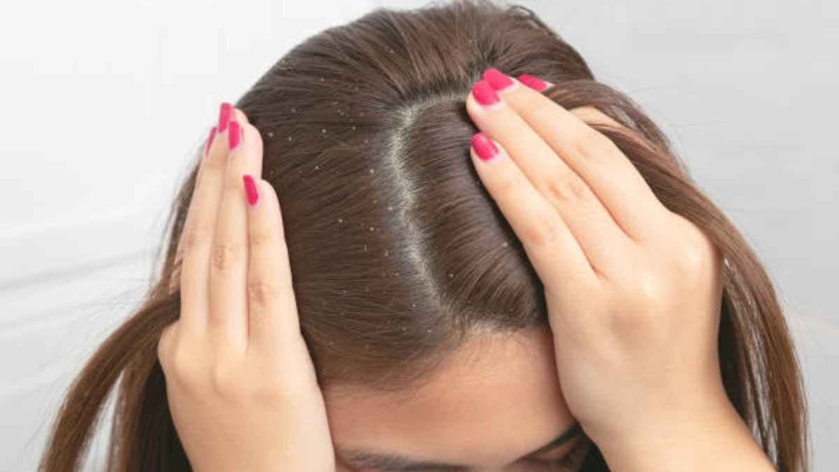  this home made natural shampoo can prevent dandruff problem and make your hair healthy lif