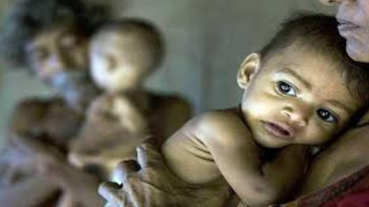 Haryana suffering from serious malnutrition among children and women