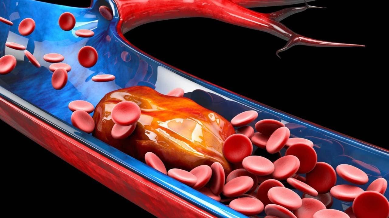 Science says Gut bacteria not cholesterol could be the real reason behind Heart attack 