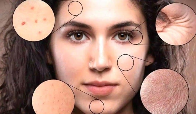 The major ways alcohol affects your skin! 