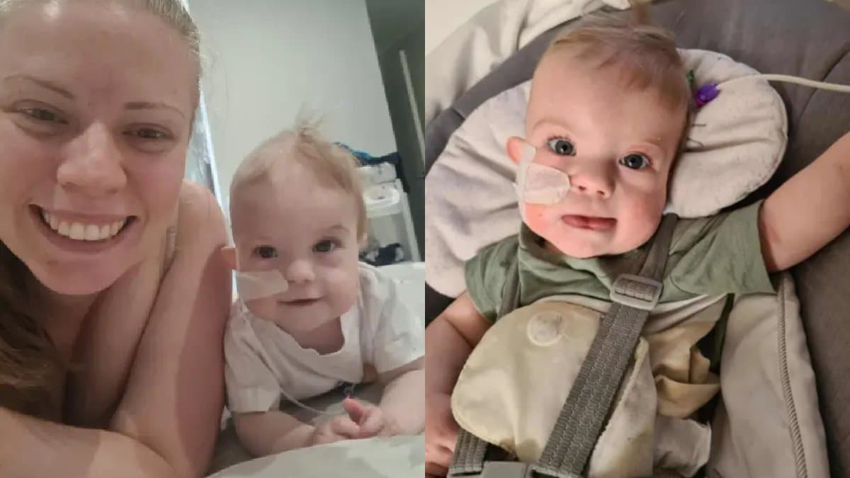 Baby goes through multiple surgery due to rare Condition