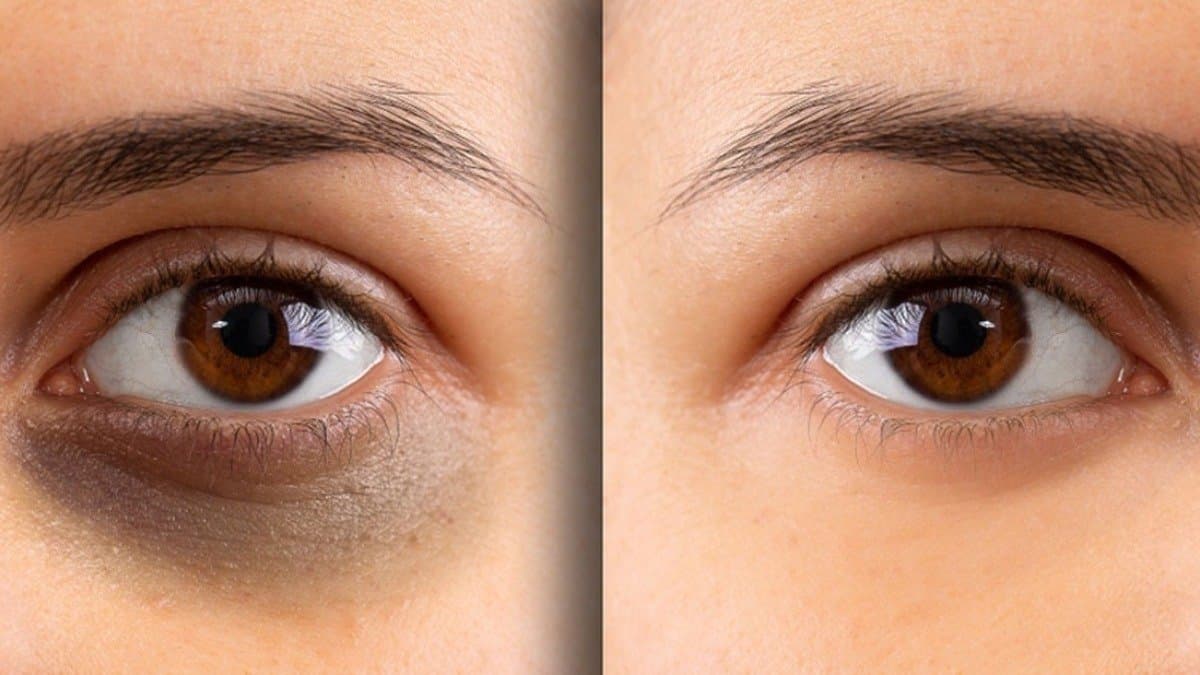 This vegetable juice can reduce dark circle problem in just 7 days 