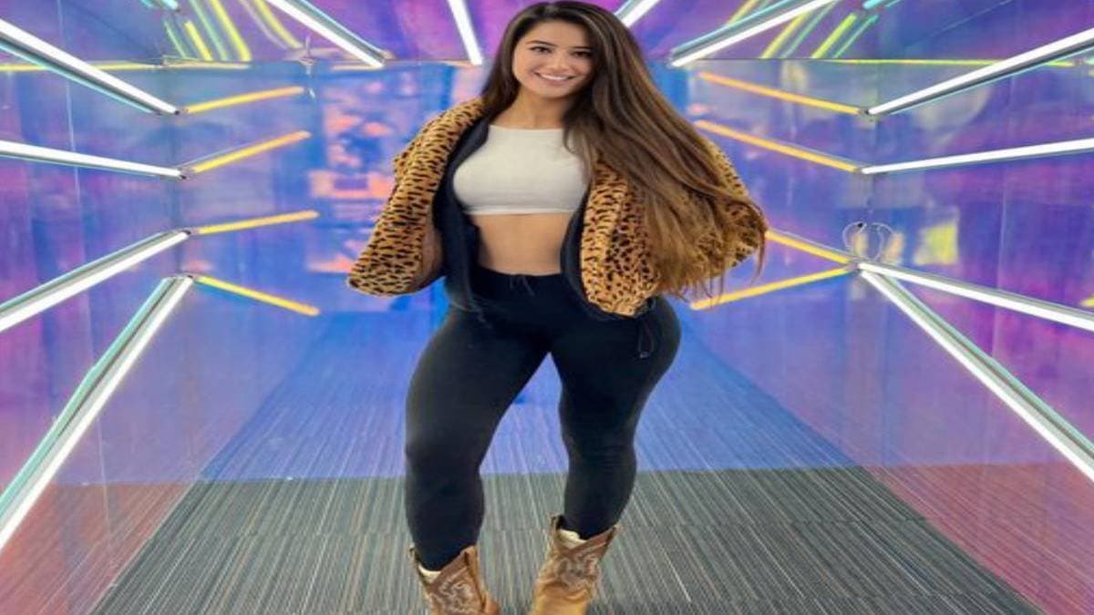 OnlyFans model Marie Temara spends million for her leg treatment