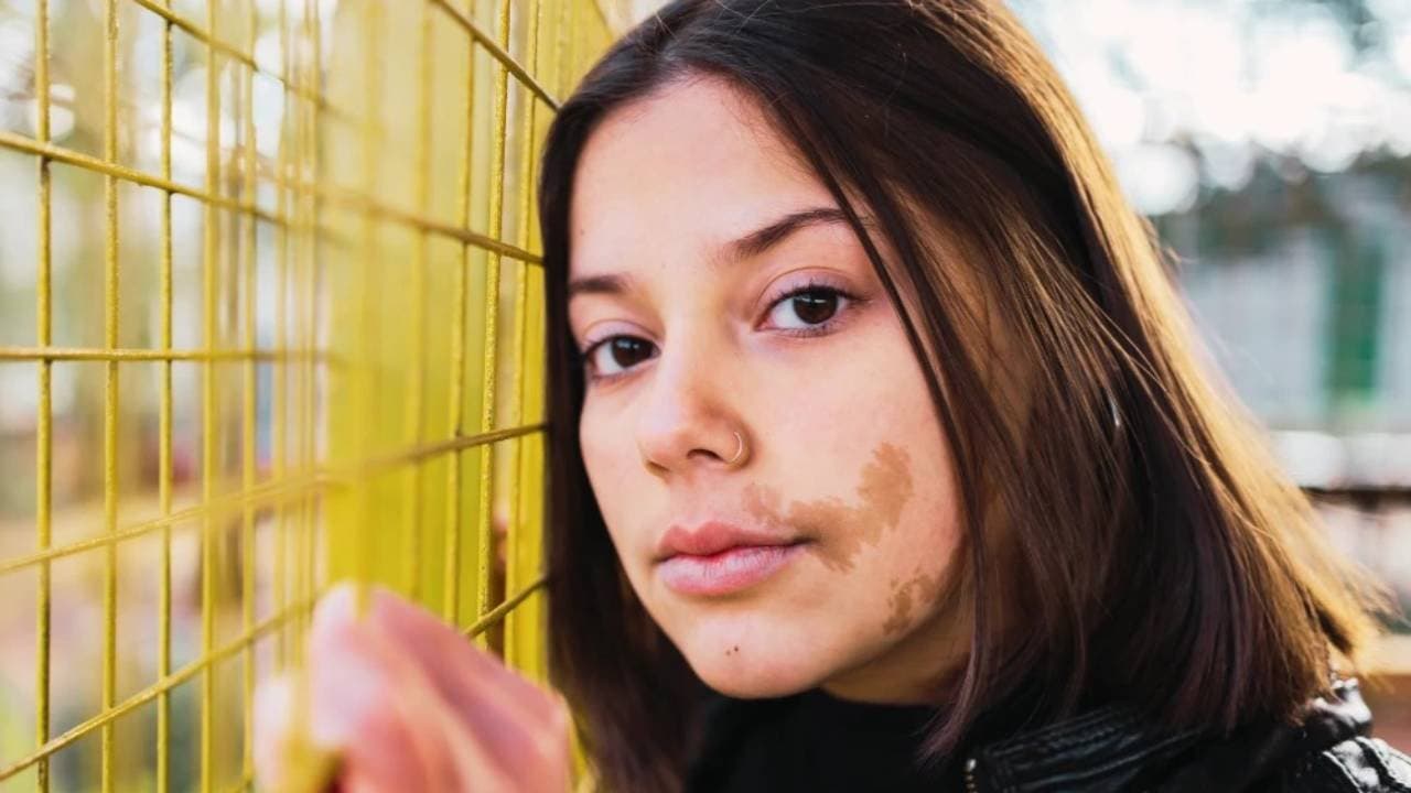 Birthmarks Meaning: Marks on your body can reveal secrets of past life 