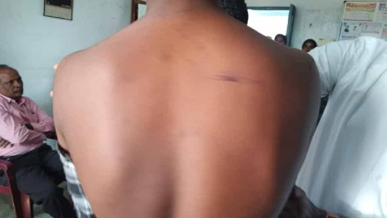 Telangana Class Ten Student Beaten With Sticks Bats By Seniors In Hostel Room 