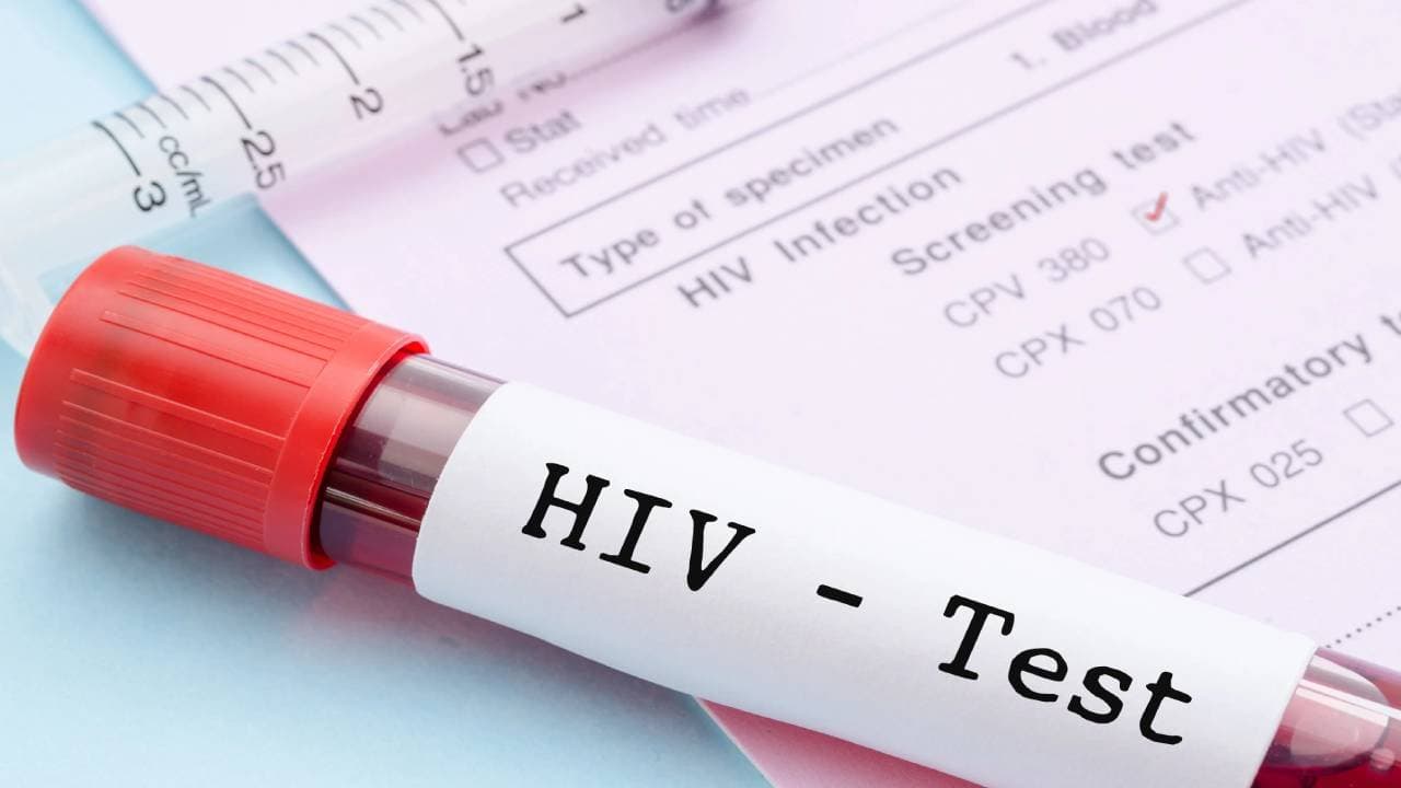 Long term cure from HIV new research by California university