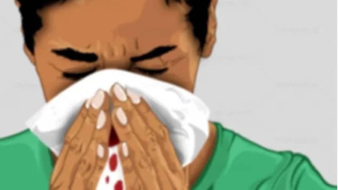 Rajasthan Mans Nose Chopped Off As Families Clash Over Love Marriage 