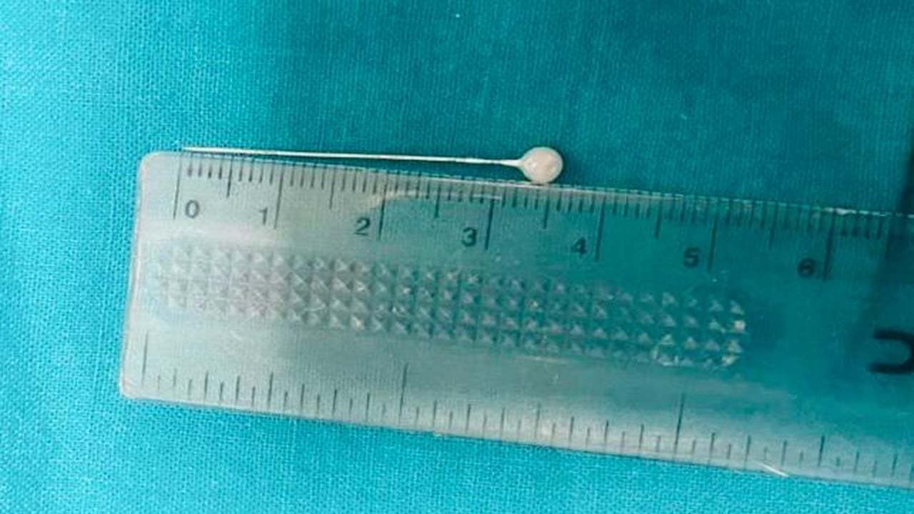 ENT doctors of Kolkata Medical College saved a life  following a quick decision