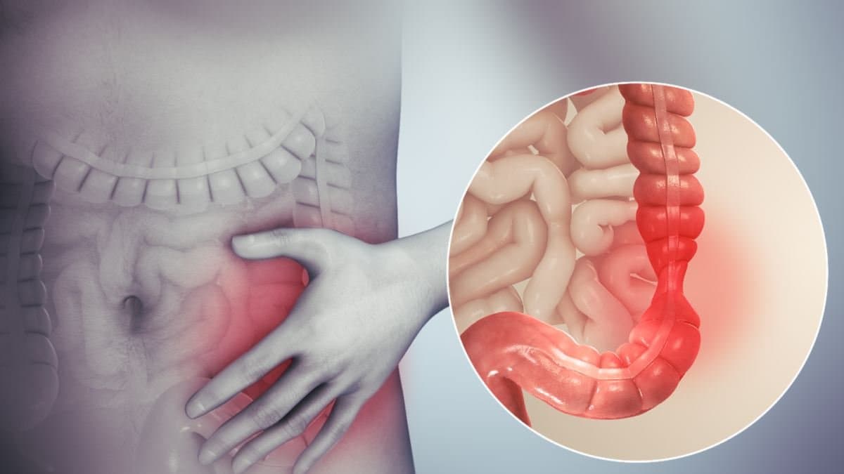 Irritable Bowel Syndrome has deep connection with Vagus Nerve