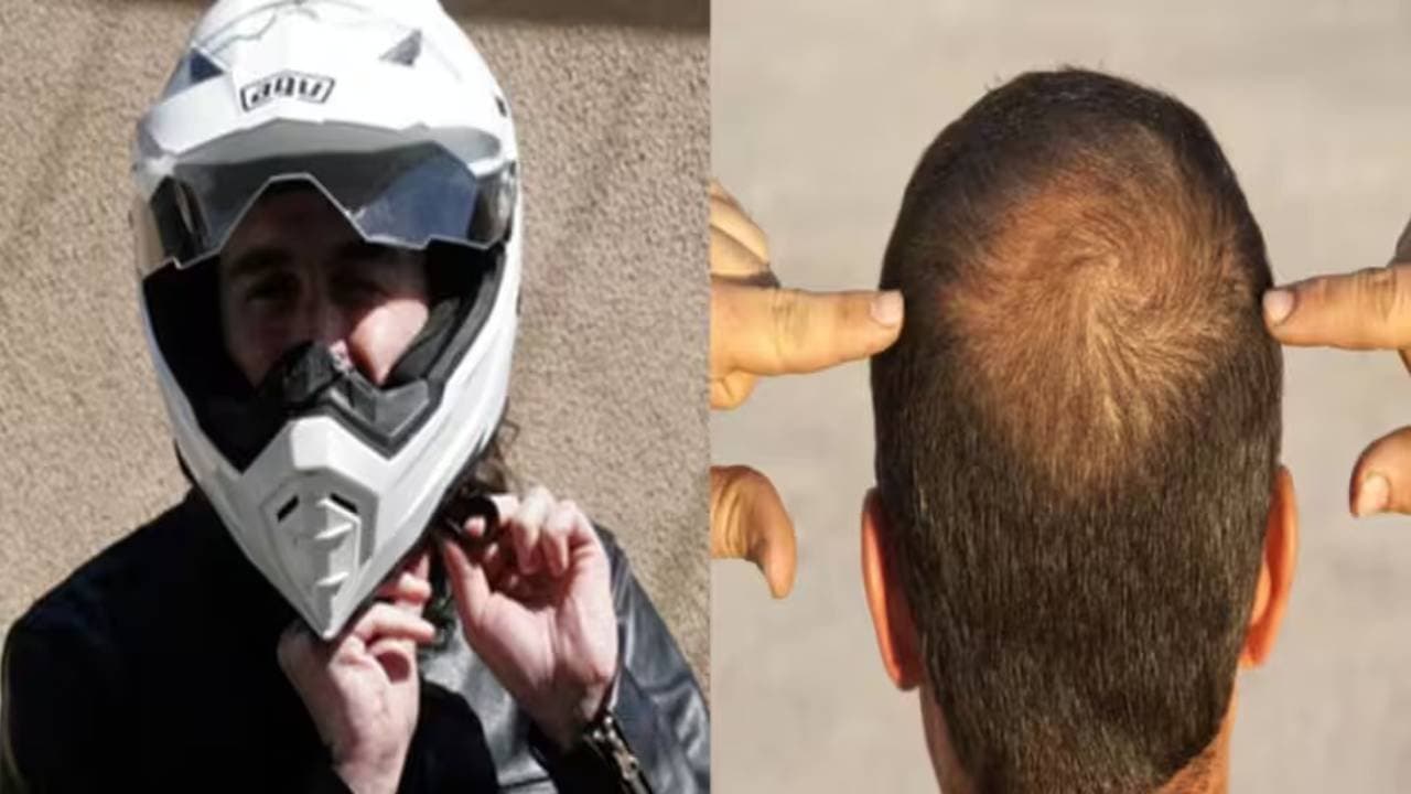 Does wearing a helmet really cause hair fall quickly 