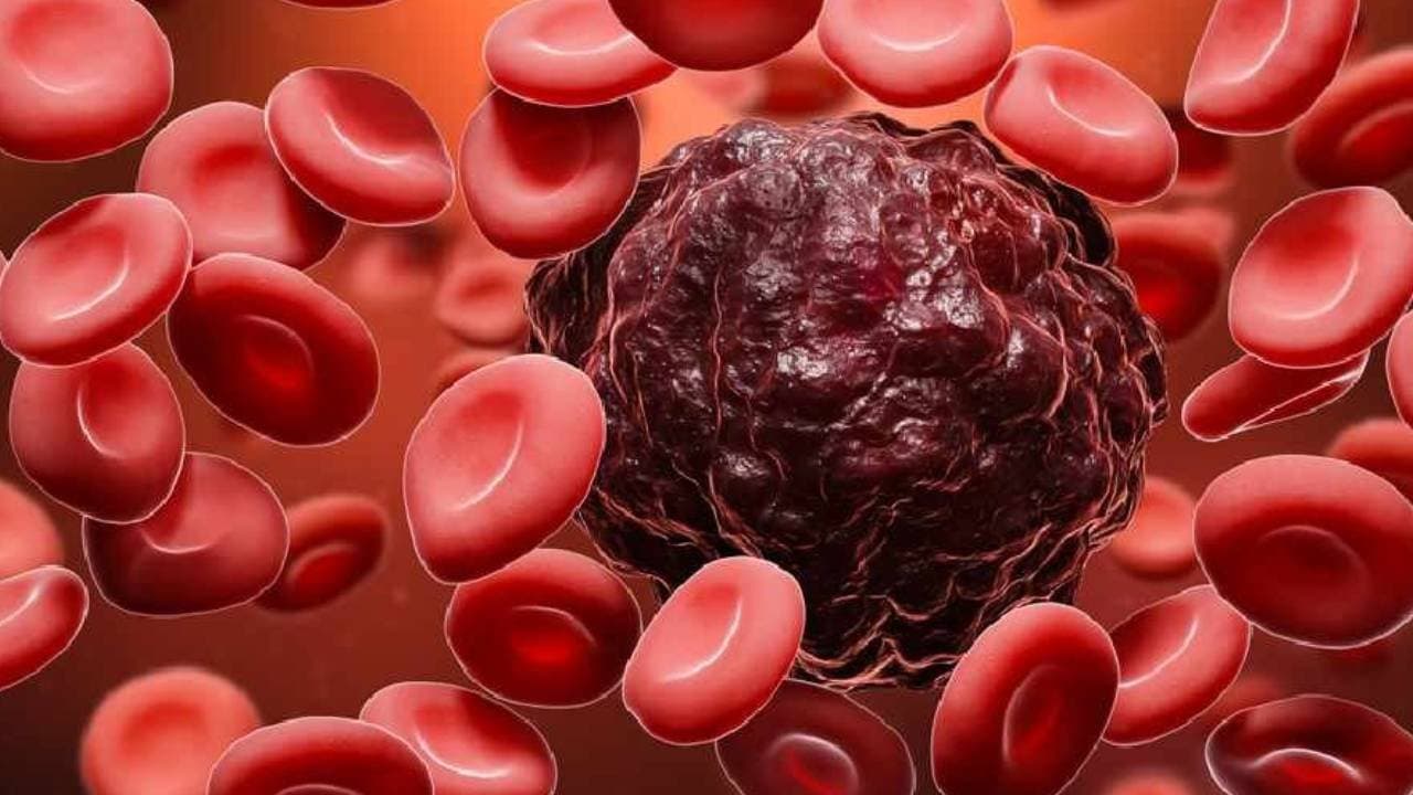 These common kitchen items can increase the risk of cancer