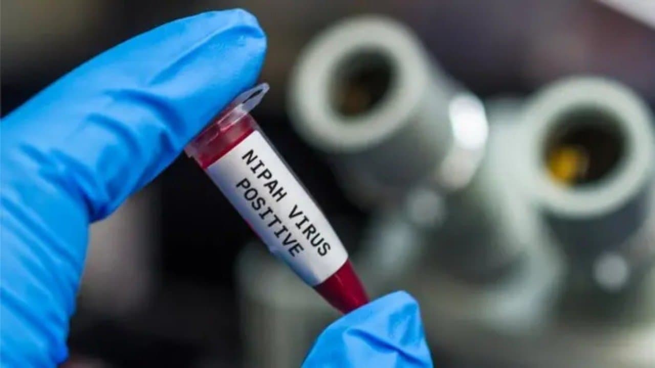 One house staff of Burdwan Medical College admitted to Beliaghata ID hospital in connection with Nipah virus