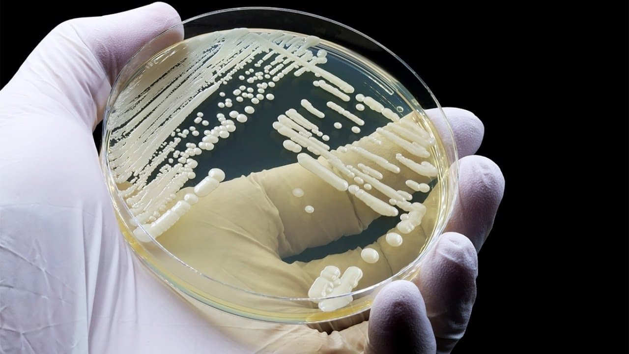 Lethal fungus resistant to drugs spreading across the world