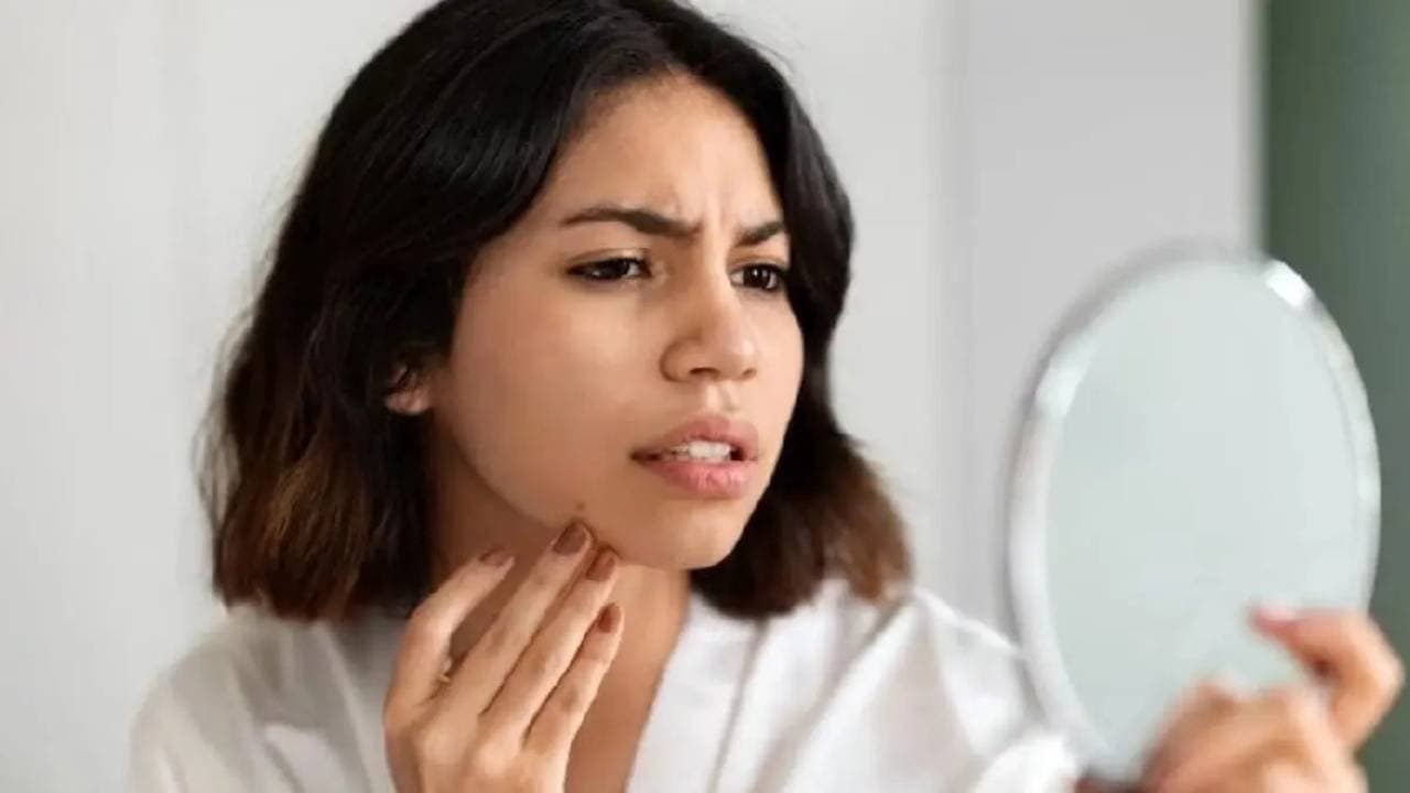 These foods prevent dry skin in winter