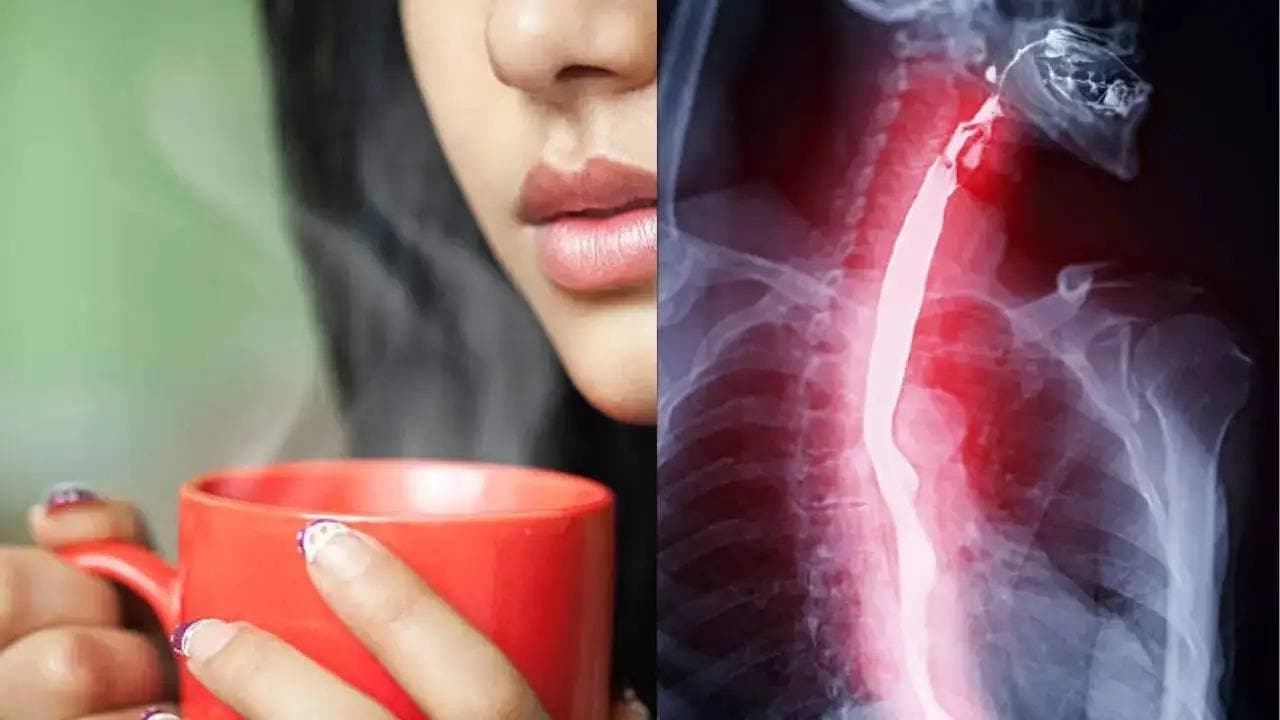 Sipping very hot beverages may raise oesophageal cancer risk