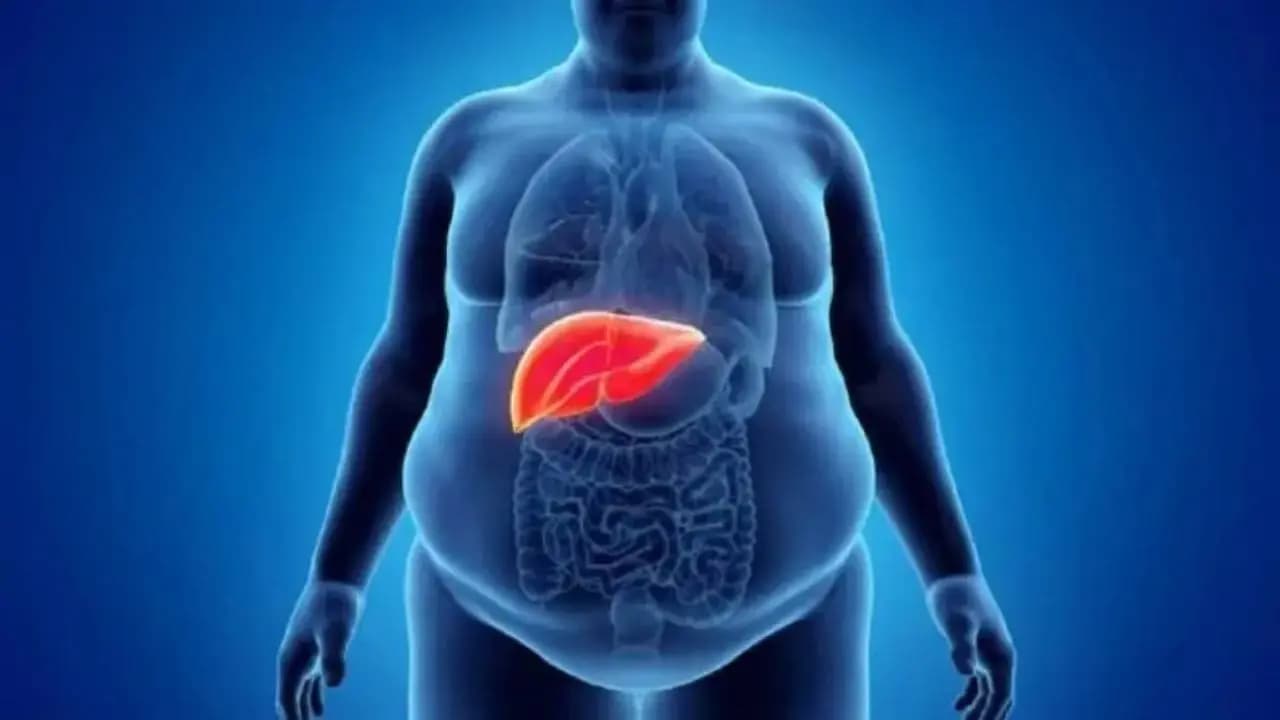 These three Vegetables Work Like Medicine for Fatty Liver