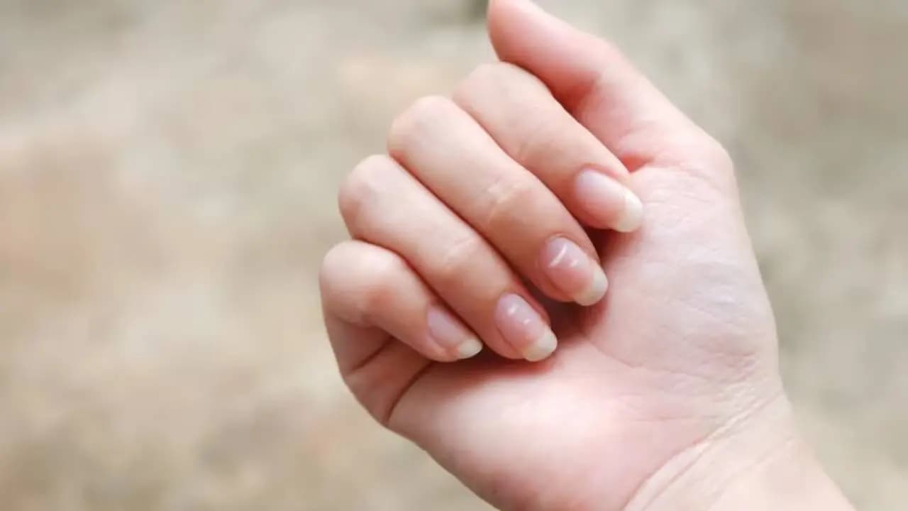 These signs of Nail can indicate major health problems 