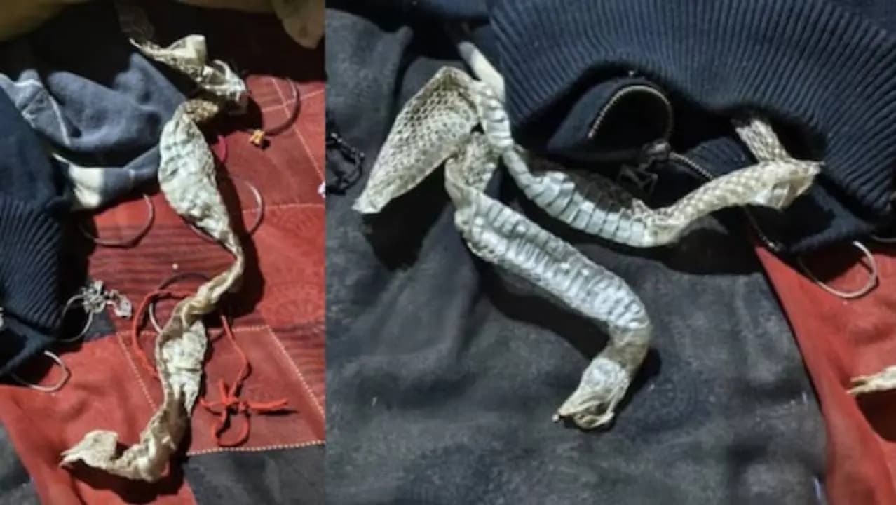 UP Woman Goes To Sleep Family Finds Snake Skin On Her Bed 