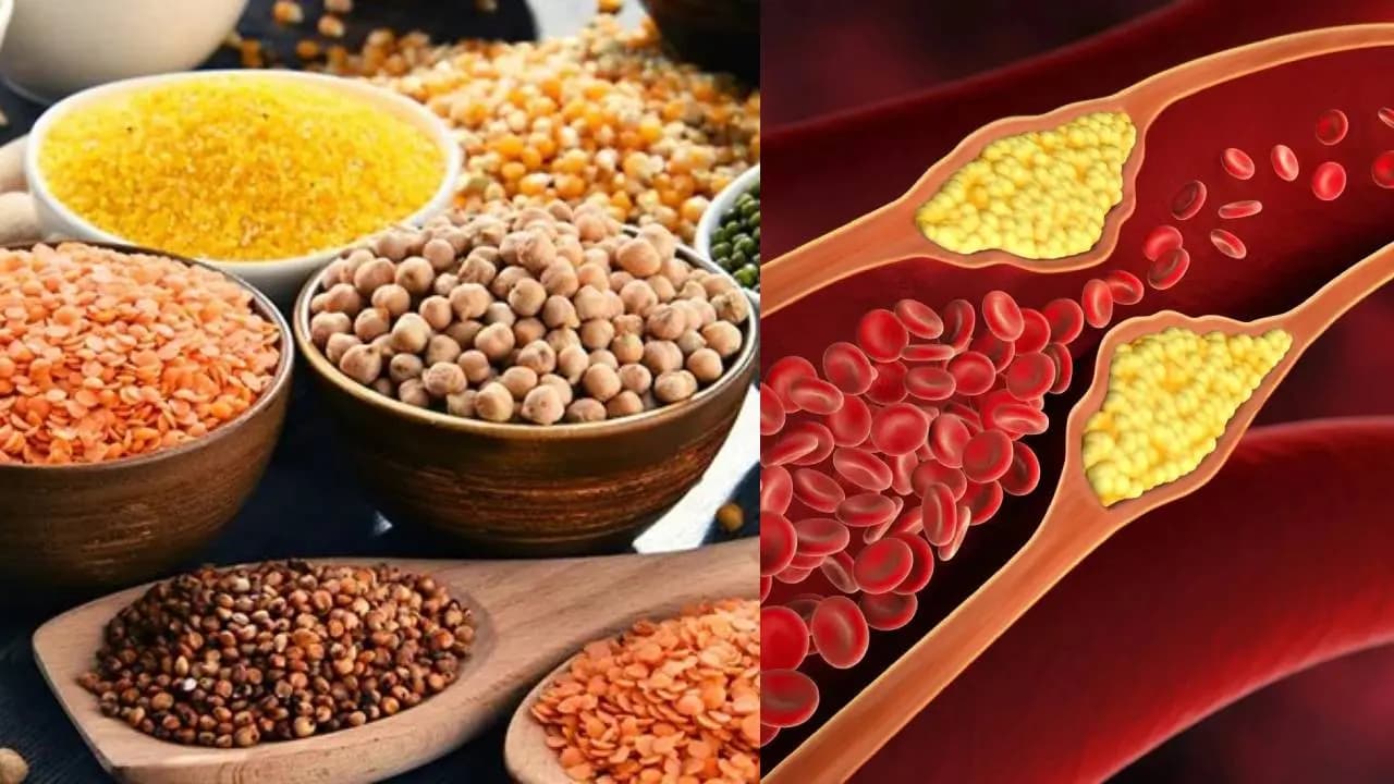Best lentils to lower high cholesterol