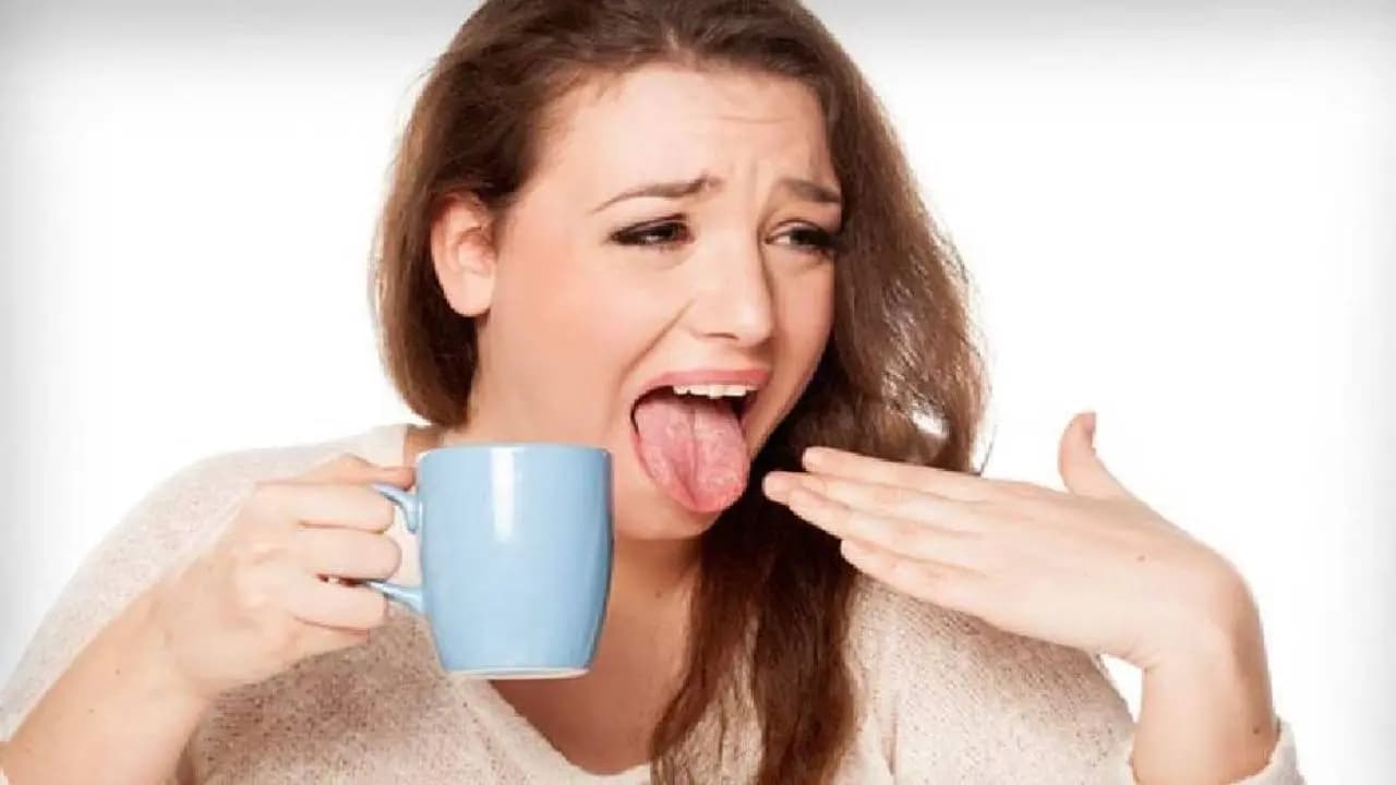 Burnt tongue home remedies instant relief