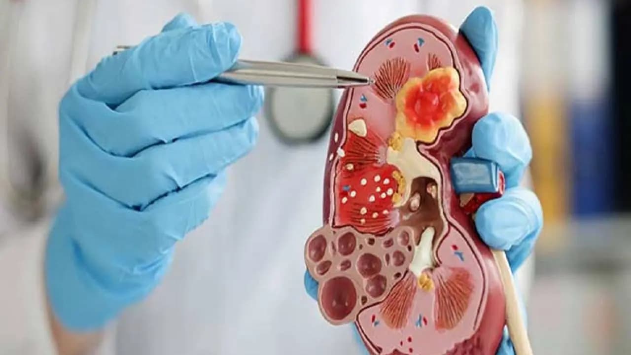 Kidney disease mental health risk new study warning
