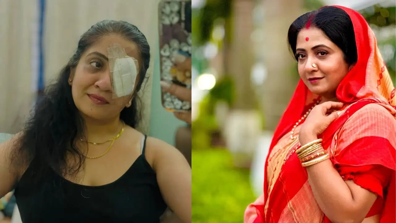 Milon hobe Kotodine fame actress sohini Sanyal  got injured by her pet