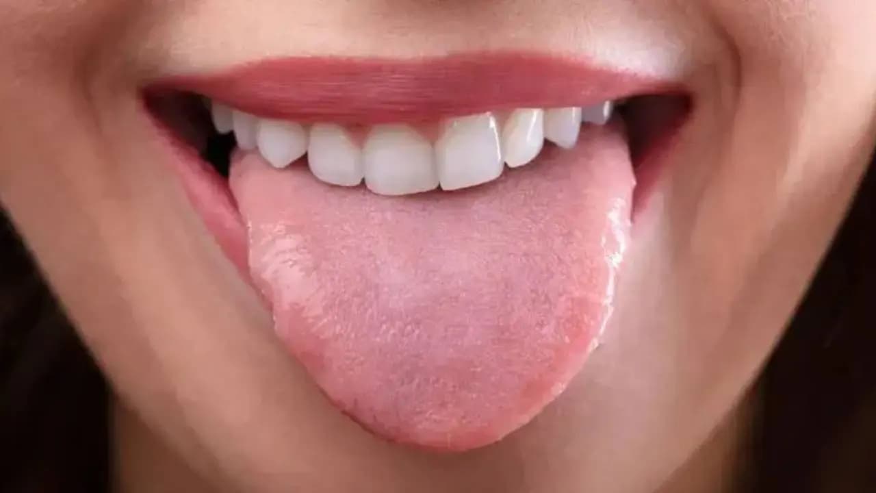 What Your Tongue Color Reveals About Your Health: Warning Signs You Should Not Ignore
