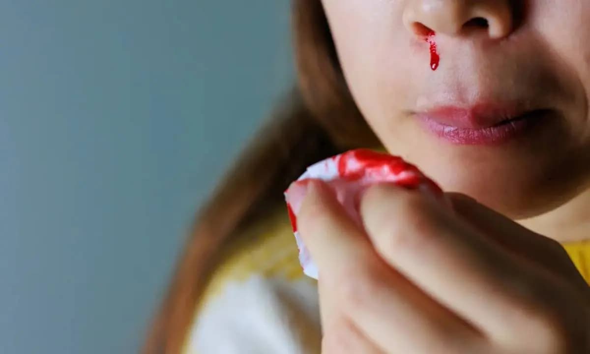 Rajasthan Man Cuts Off Mother-in-Law’s Nose With Scissors Following Family Dispute; Suspect At Large