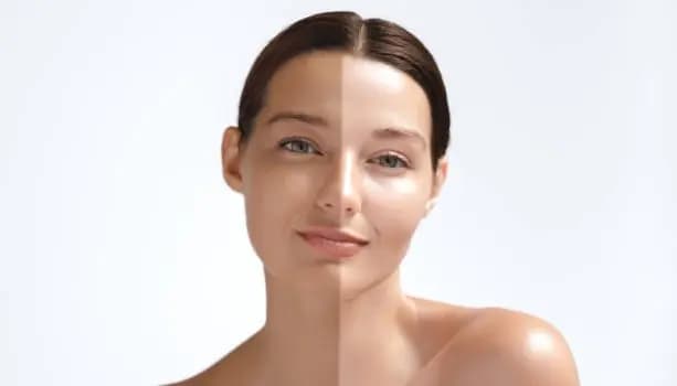 How to Remove Sun Tan Naturally: 6 Homemade Face Packs for Glowing Skin This Summer