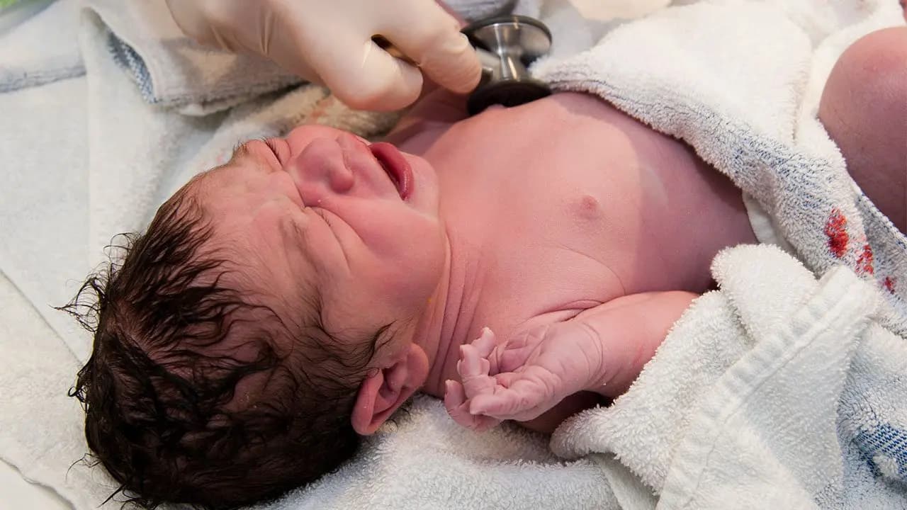 Rare Medical Miracle: Baby Born with Diphallia in Pakistan Discharged After Successful Surgery