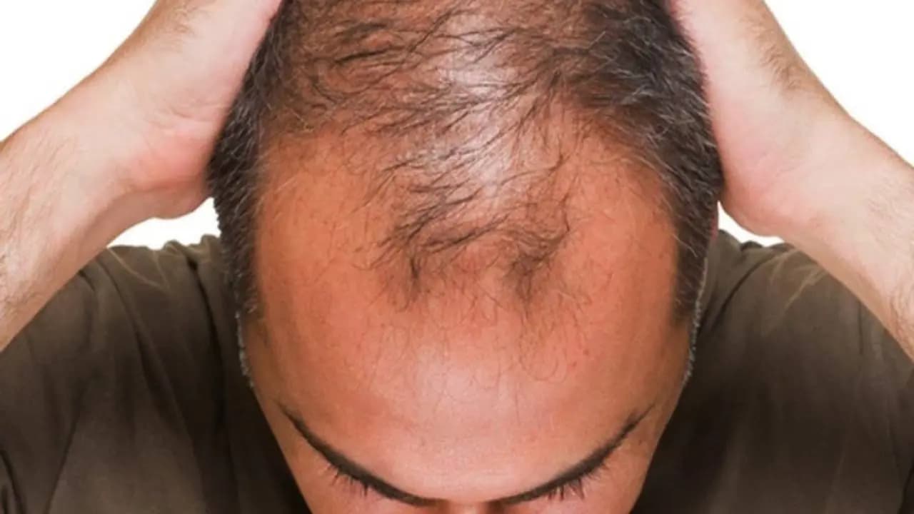 Hair Care Mistakes: 5 Common Daily Habits That Cause Hair Loss and Scalp Damage