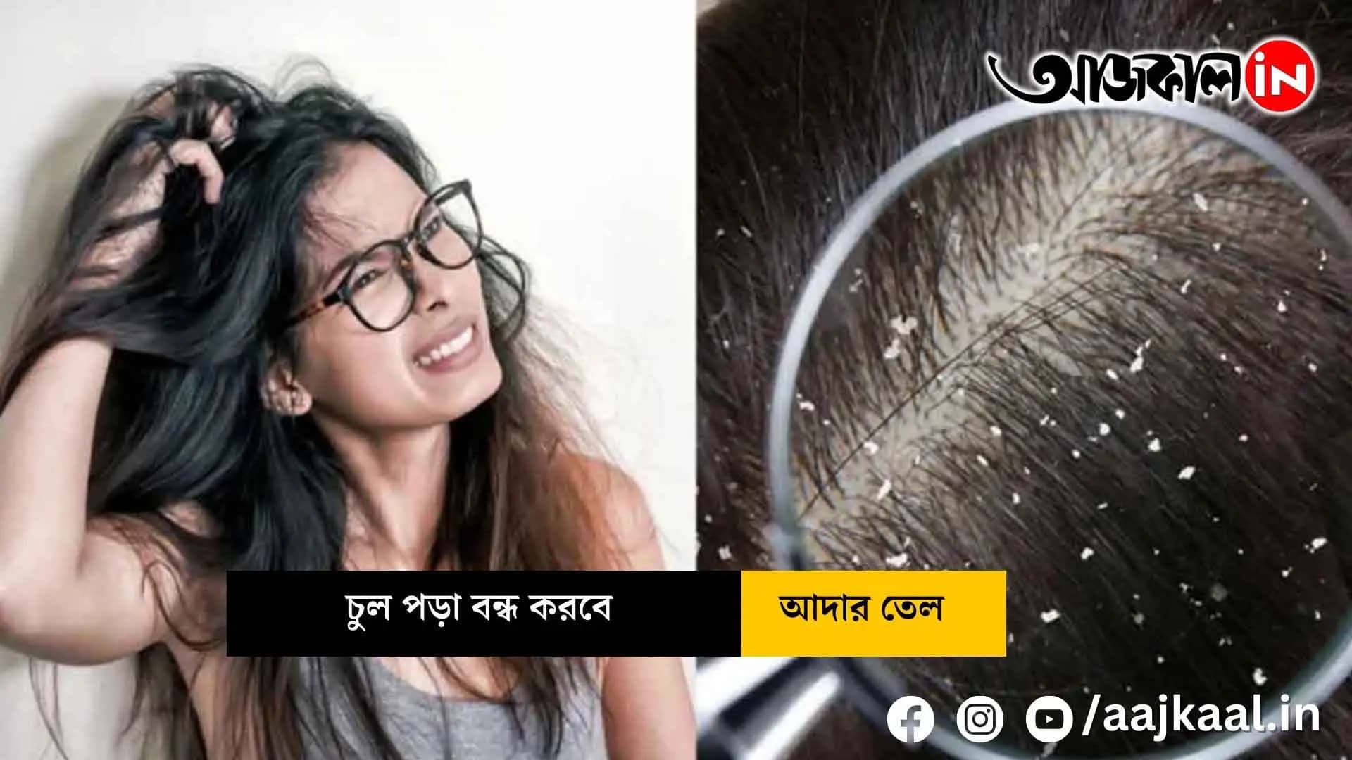  Not coconut oil, ginger oil will stop hair loss!