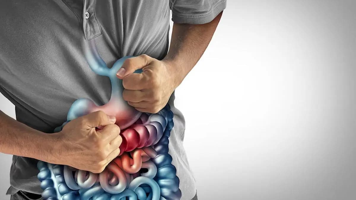 what are the remedies of irritable bowel syndrome or ibs lif