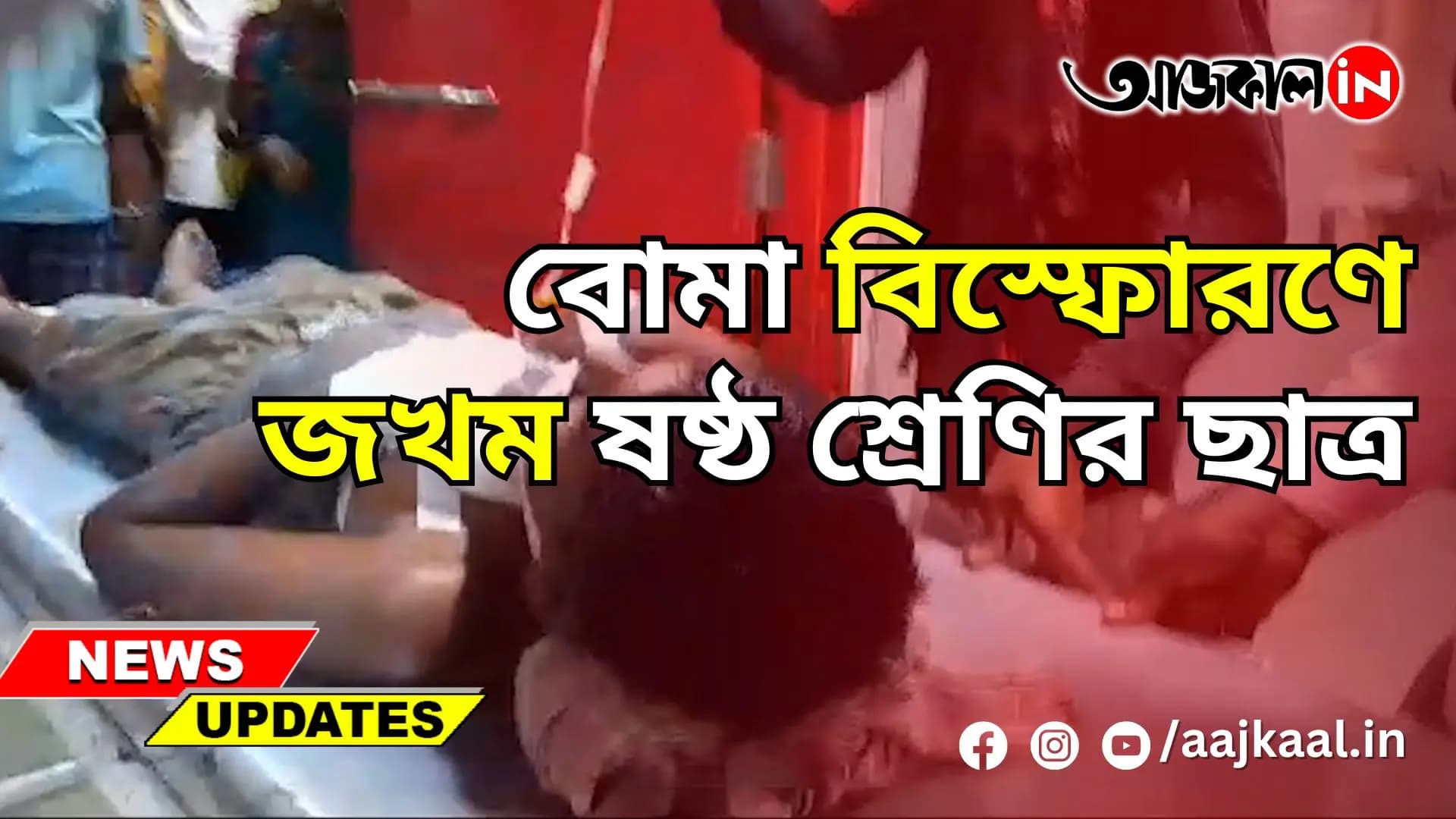 বোমা বিস্ফোরণে জখম ষষ্ঠ শ্রেণির ছাত্র
