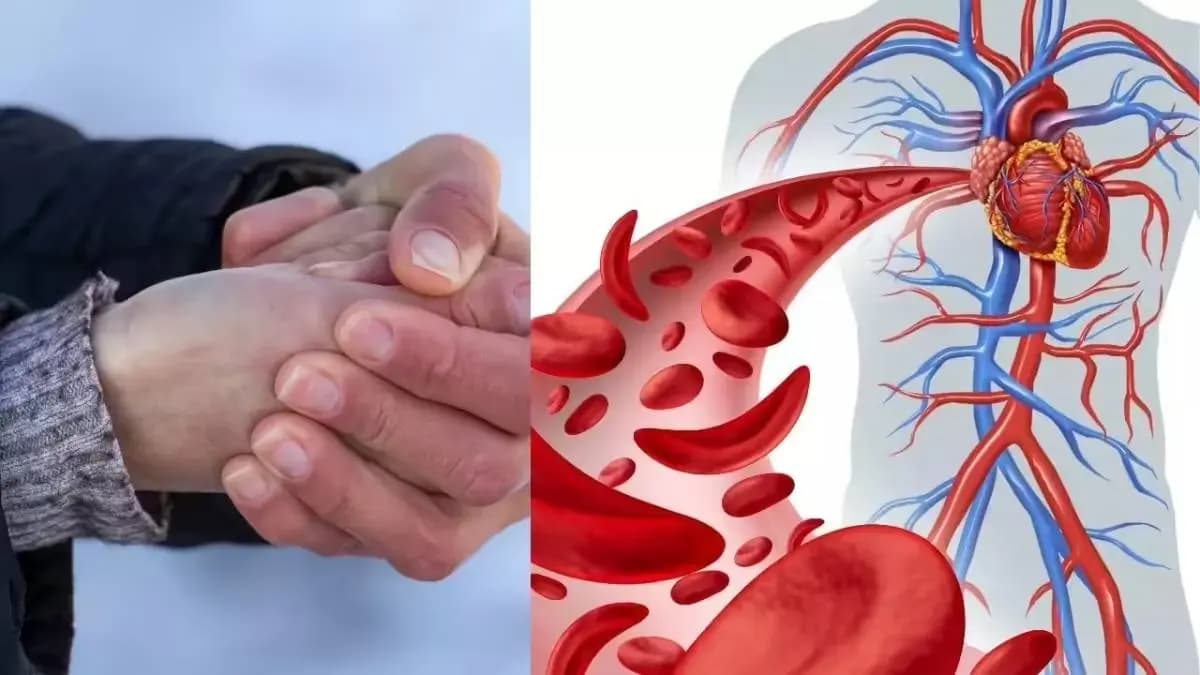Health Tips: Cold hands and feet could be a serious warning sign