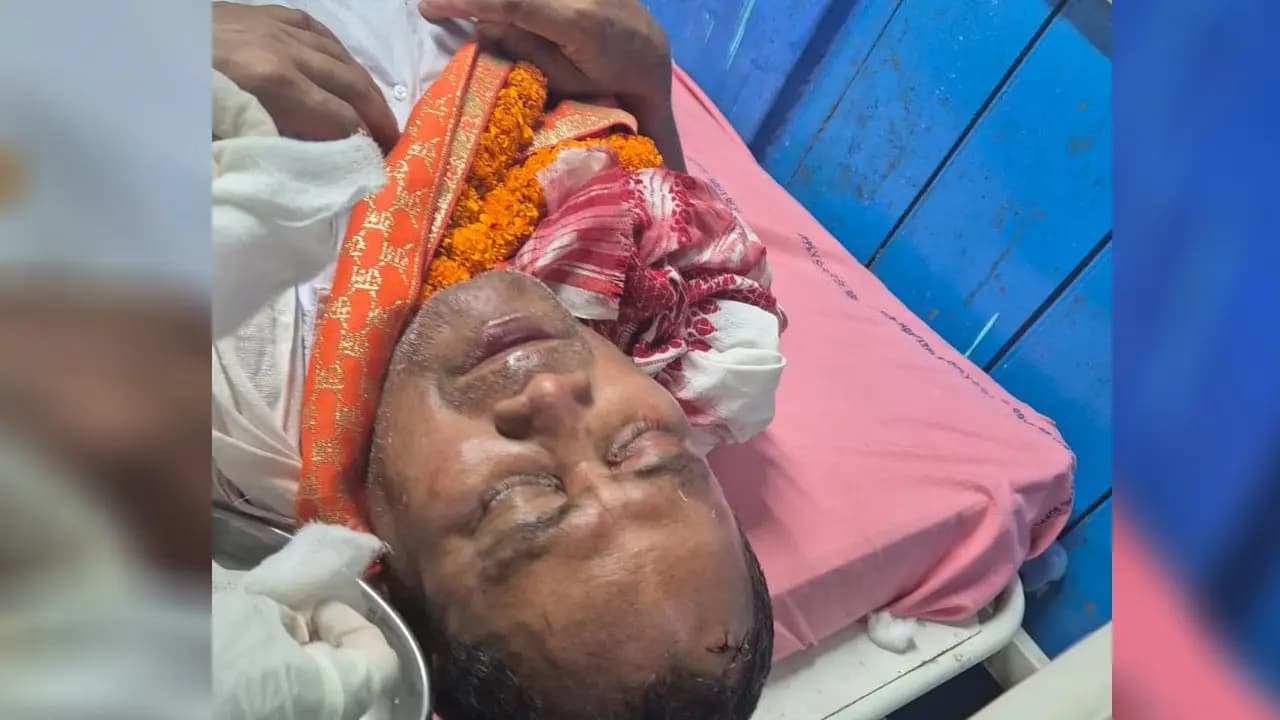 BJP Candidate Dalim Roy Injured During Election Campaign in Maynaguri