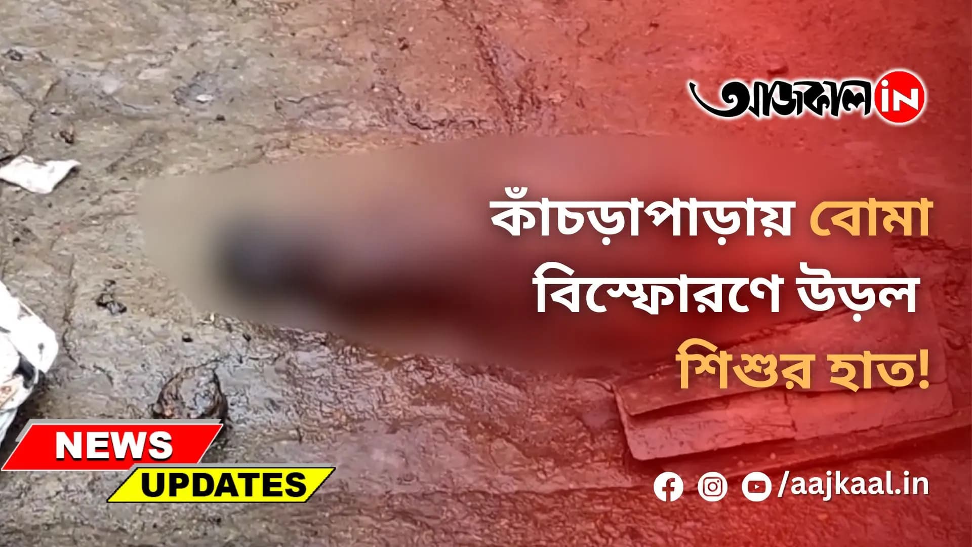 কাঁচড়াপাড়ায় বোমা বিস্ফোরণে উড়ল শিশুর হাত!
