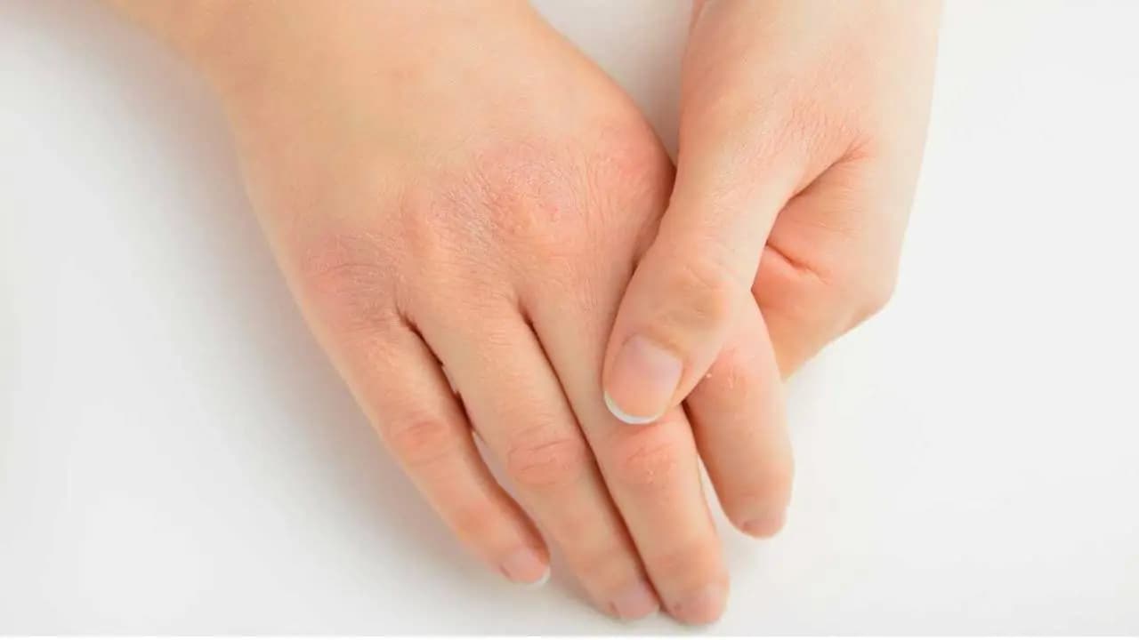 Vitamin Deficiency Symptoms: Warning Signs Your Body Gives for Lack of Essential Micronutrients