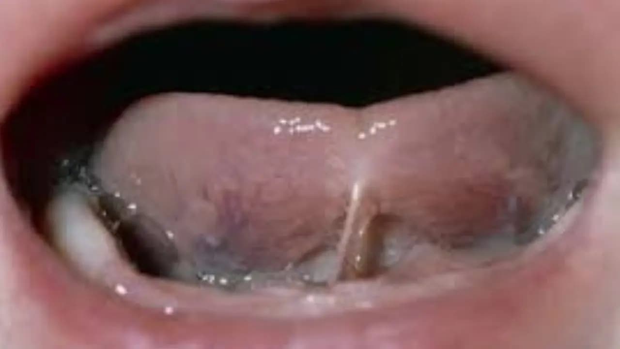 MP woman chopped off her tongue in superstition