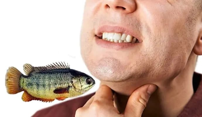Youth died after he took a climbing fish in his mouth gnr