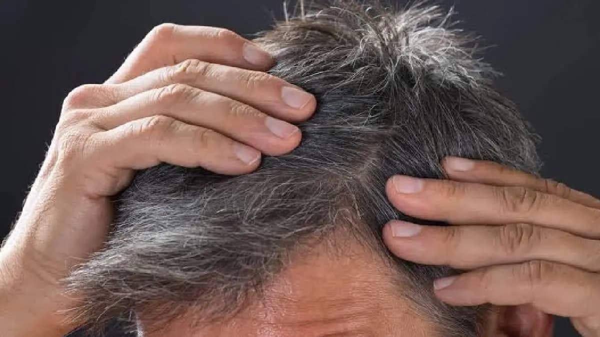 Use Amla and coconut oil to prevent gray hair