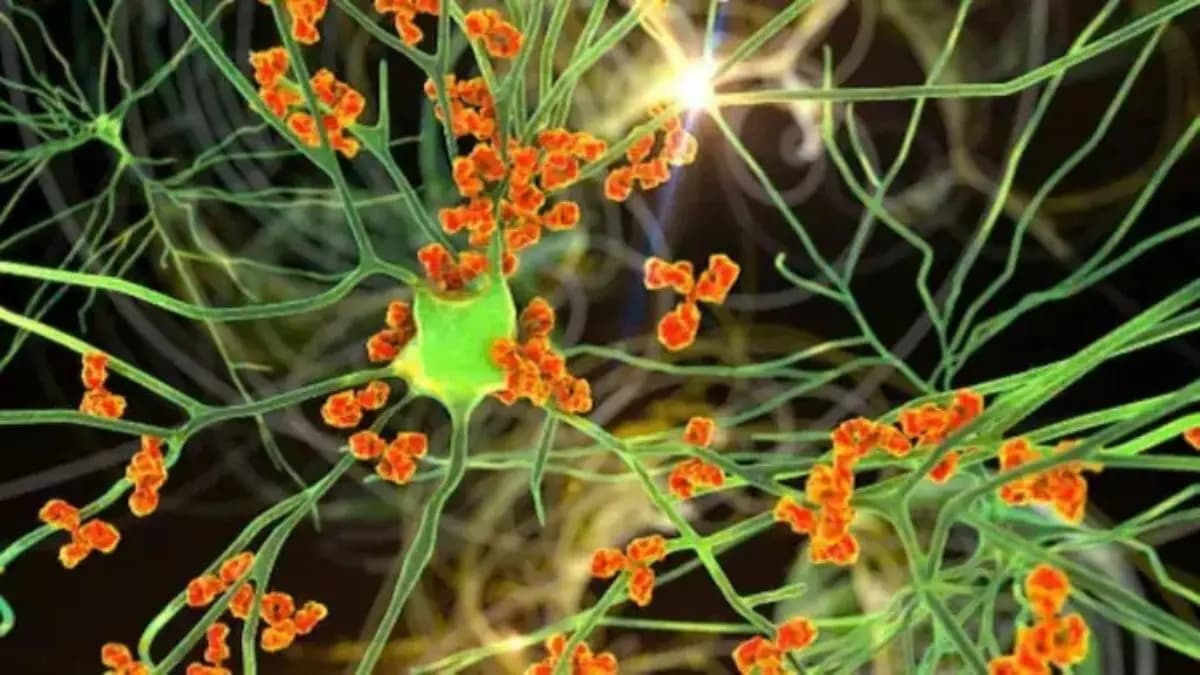 What Causes Guillain Barre Syndrome how dangerous this disease Renowned Neuro Doctor Saptarshi Basu explains its symptoms and all details lif