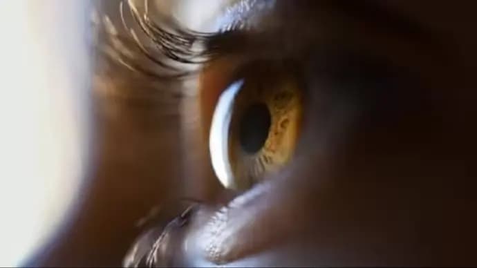 patients claim loss of vision after surgery at Gujarat hospital