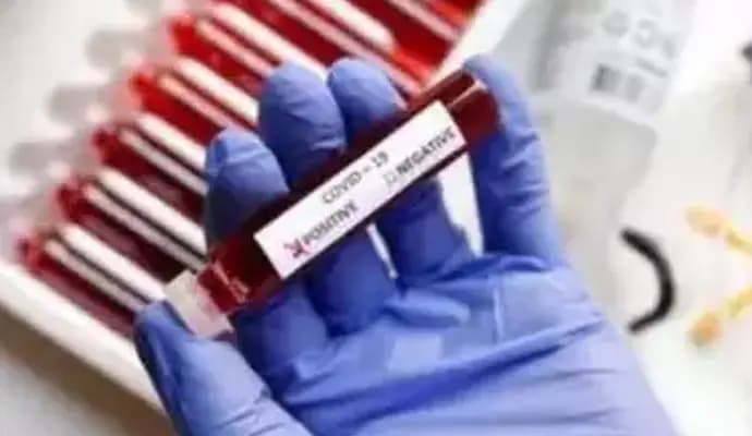 India records 441 new Covid-19 cases in 24 hours, no fresh death
