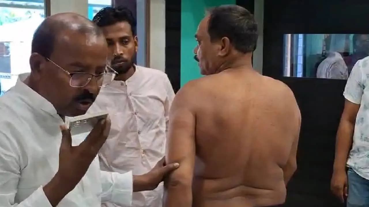 Bengal Elections 2026: TMC Worker Brutally Beaten While On His Way to Vote