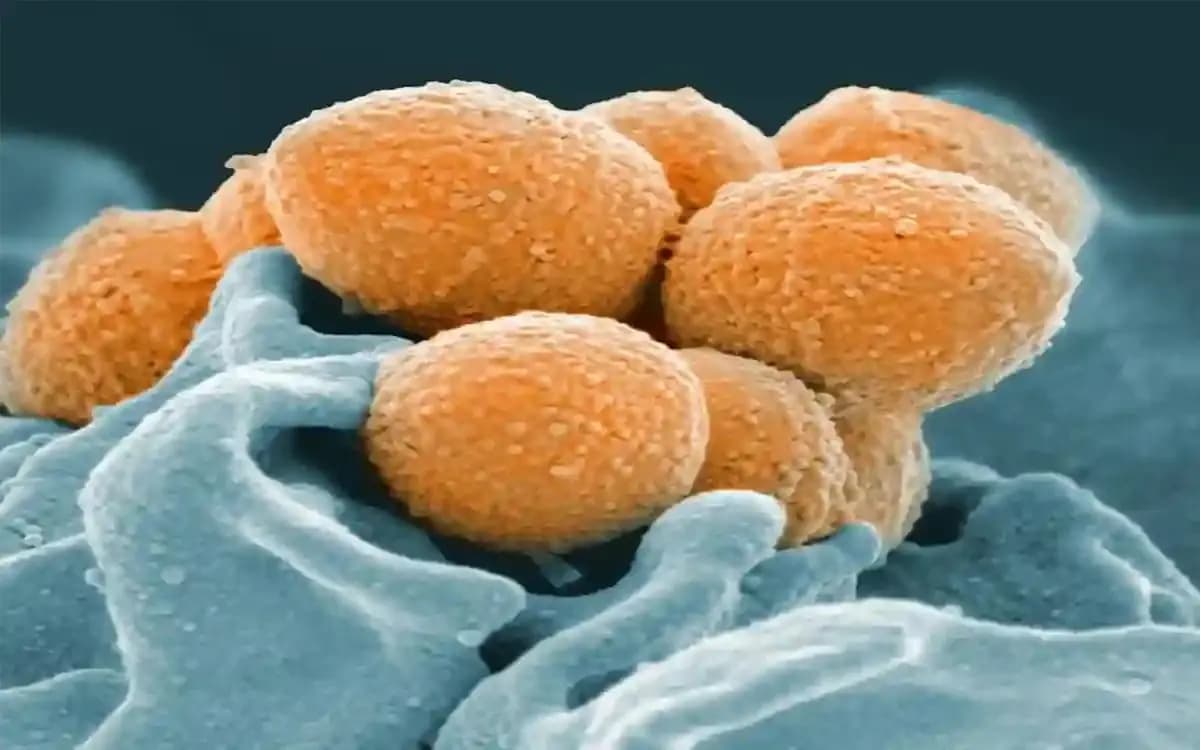 Rare flesh-eating bacteria spreads in Japan