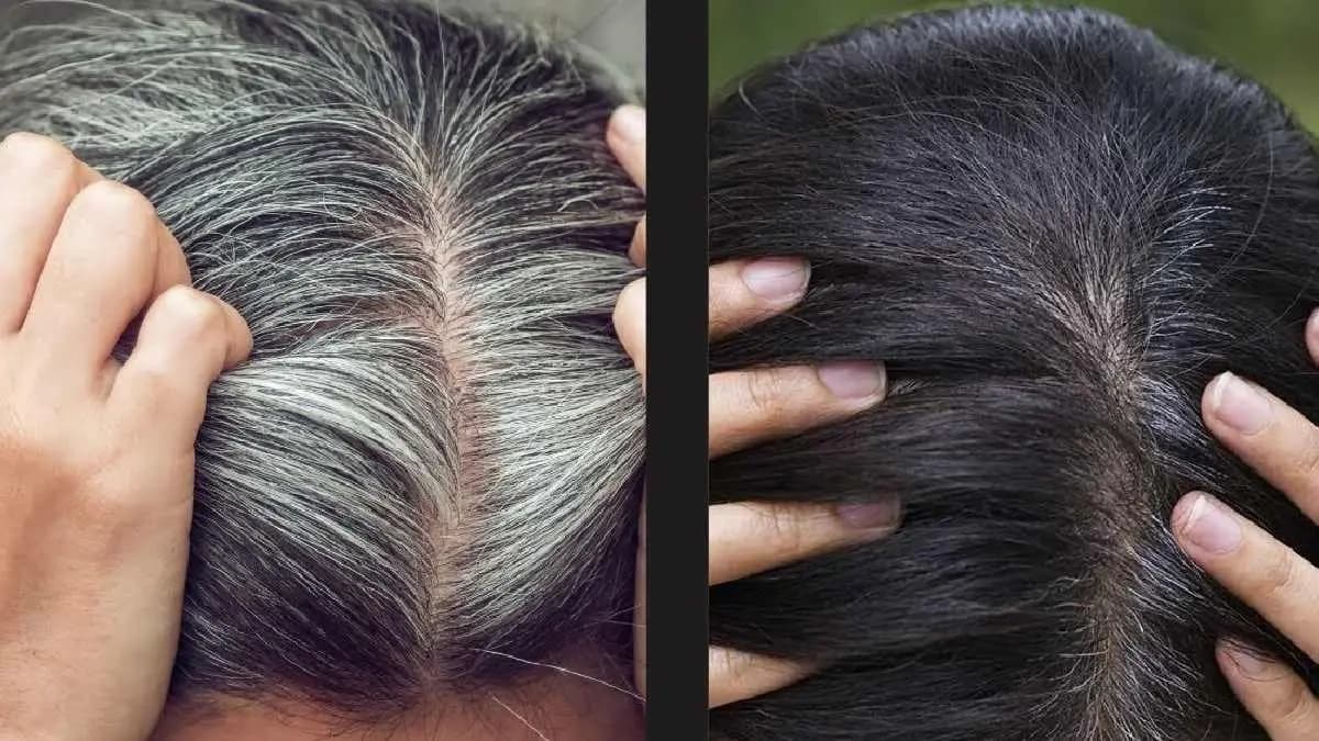 Scientists discovered stem cells for melanocyte in hair follicles which can turn gray hairs back to black