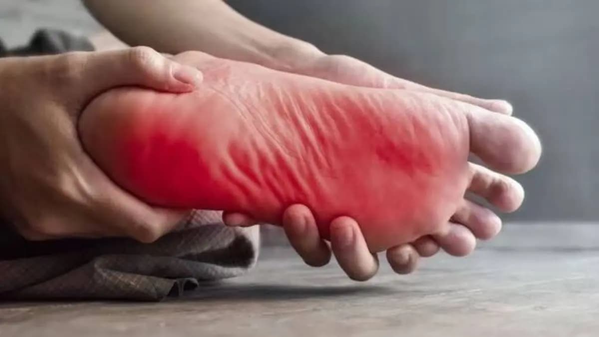 These serious health problems often begin with burning sensation in your soles