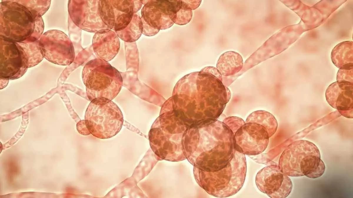 Deadly Fungal Infections Are Evolving And Causing Silent Pandemic gnr