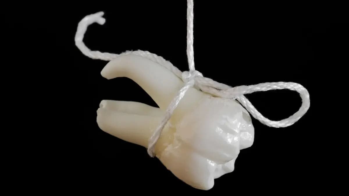 Stem cells extracted from Wisdom teeth can potentially Cure Nerve Disease and Heart Failure